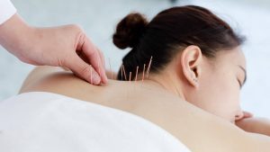 Acupuncture Examining Its Advantages and Potential